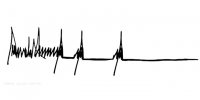 TRUMP SIGNATUREHEARTBEAT.jpeg