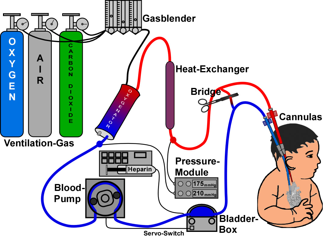 Ecmo_schema-1-.jpg