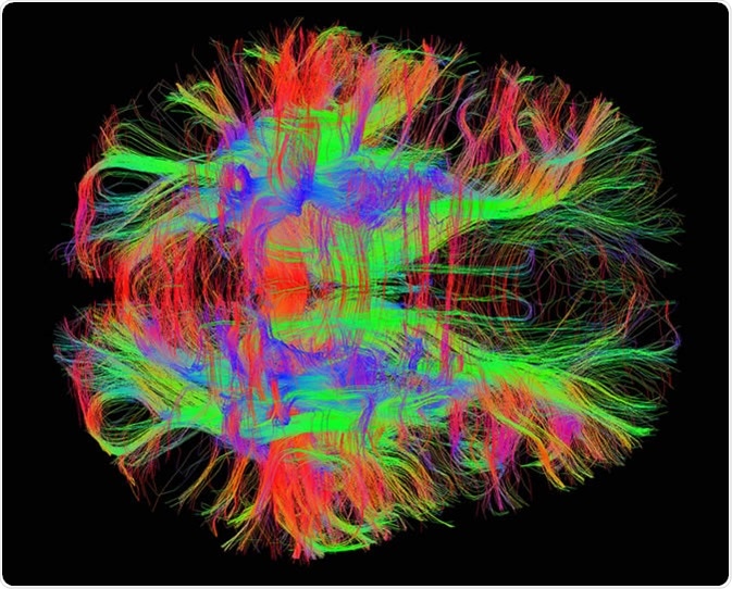 White matter fiber tracts in the adult human brain. Image Credit: Zeynep Saygin, mcgovern.mit.edu