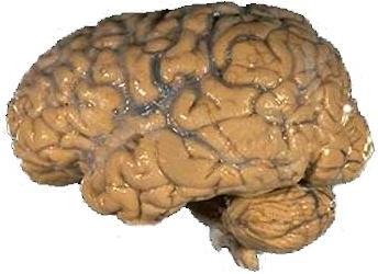 Human_brain_NIH.jpg