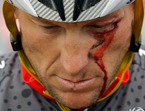 Lance-Armstrong-bleeds-fr-001.jpg