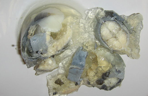 jellied-eels-12184710261.jpg